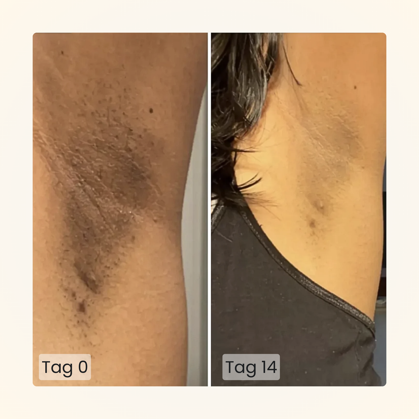 Gloomi® Skin Essence Bar (2er Pack) + Routine Set