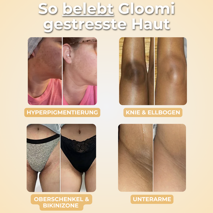 Gloomi® Skin Essence Bar (2er Pack) + Routine Set