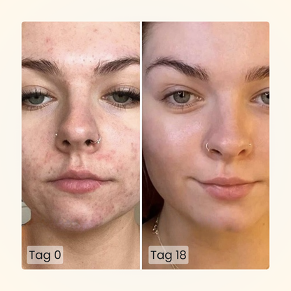 Gloomi® Skin Essence Bar (2er Pack) + Routine Set