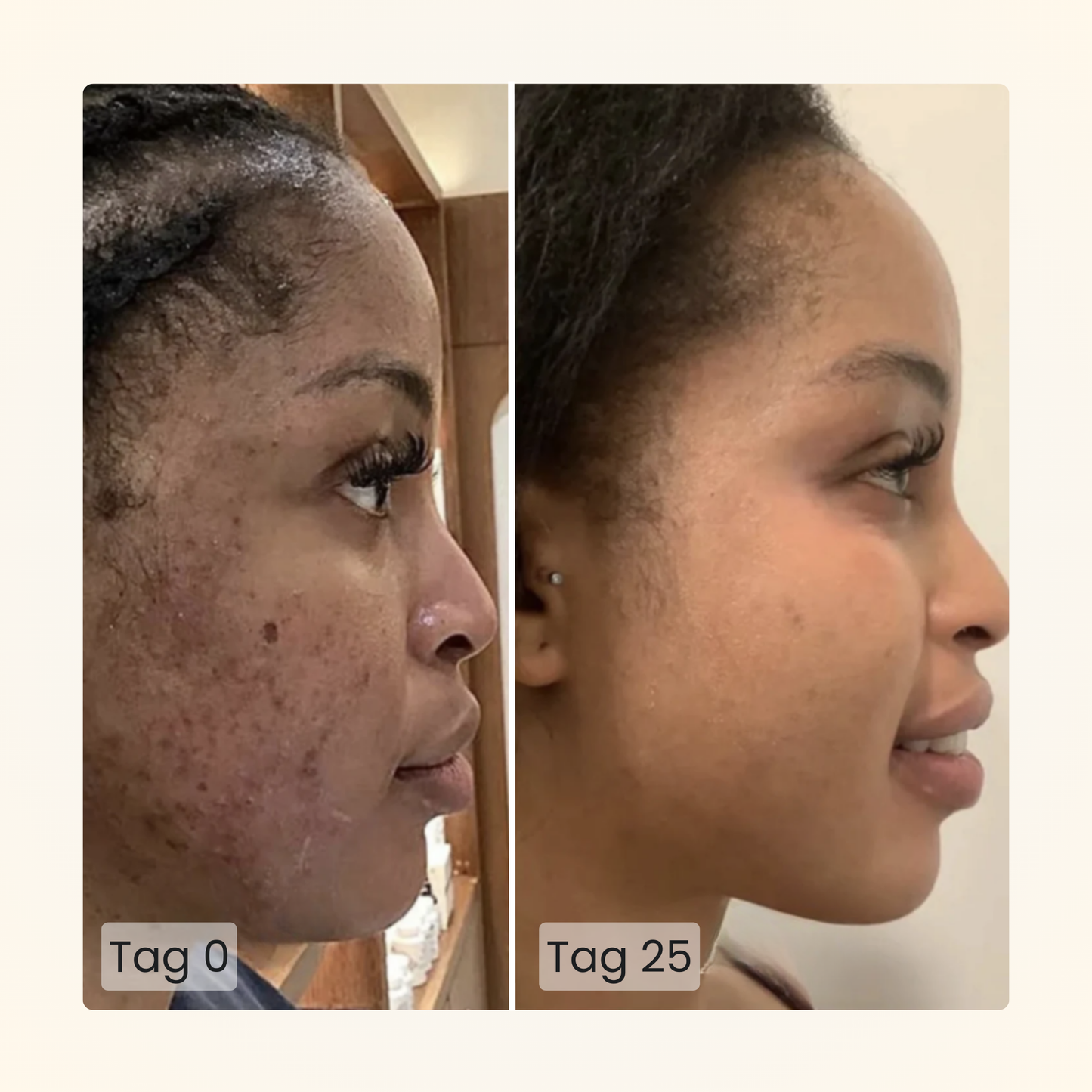 Gloomi® Skin Essence Bar (2er Pack) + Routine Set