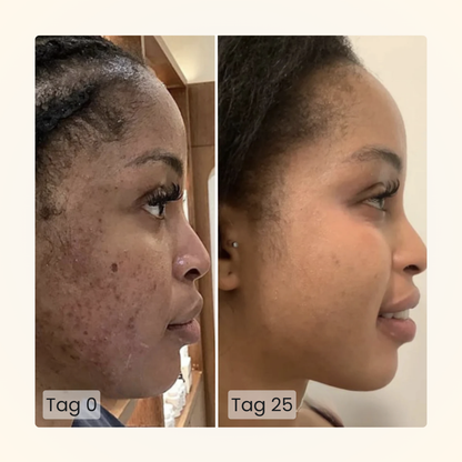 Gloomi® Skin Essence Bar (2er Pack) + Routine Set