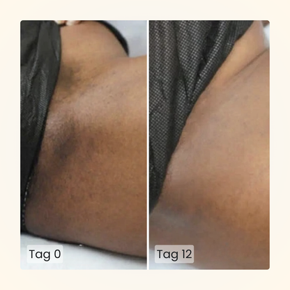 Gloomi® Skin Essence Bar (2er Pack) + Routine Set