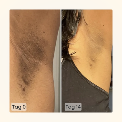 Gloomi® Skin Essence Bar (2er Pack) + Routine Set