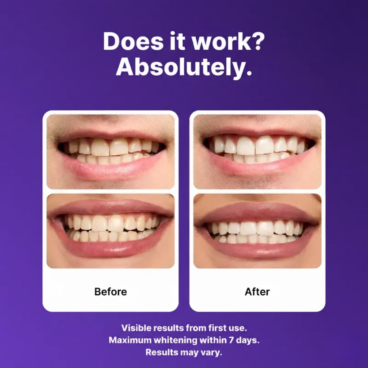 Teeth Whitening Stripes