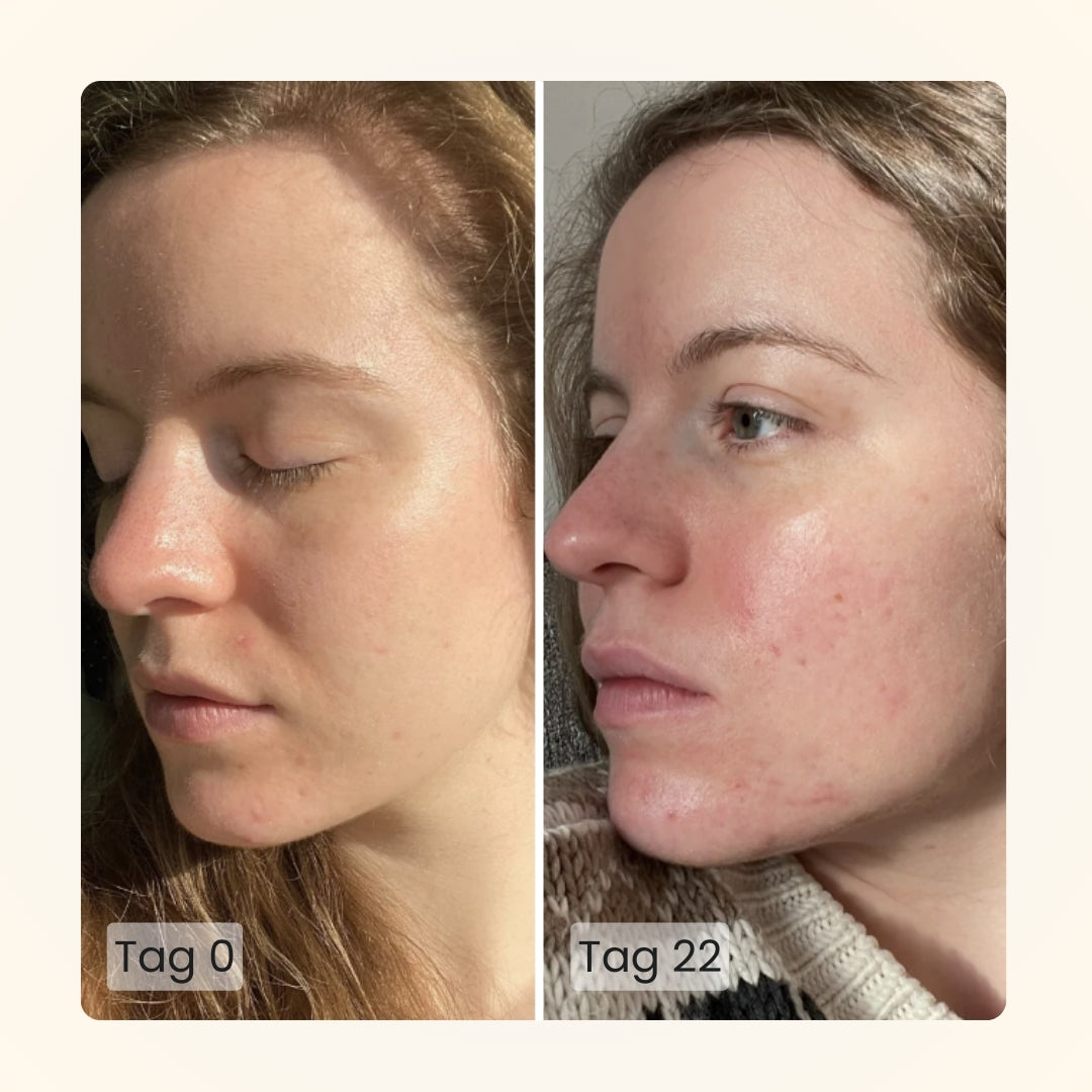 Gloomi® Skin Essence Bar (2er Pack) + Routine Set