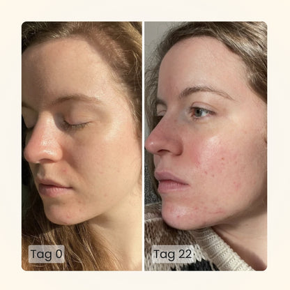 Gloomi® Skin Essence Bar (2er Pack) + Routine Set