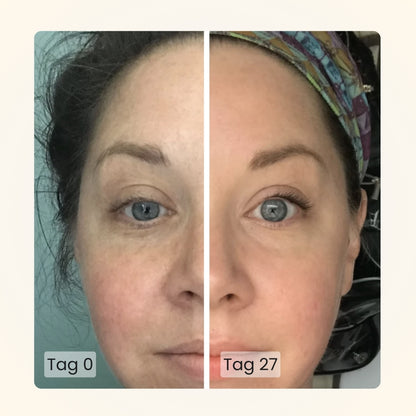 Gloomi® Skin Essence Bar (2er Pack) + Routine Set