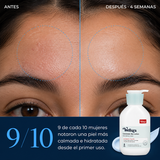 Antes y después 4 semanas