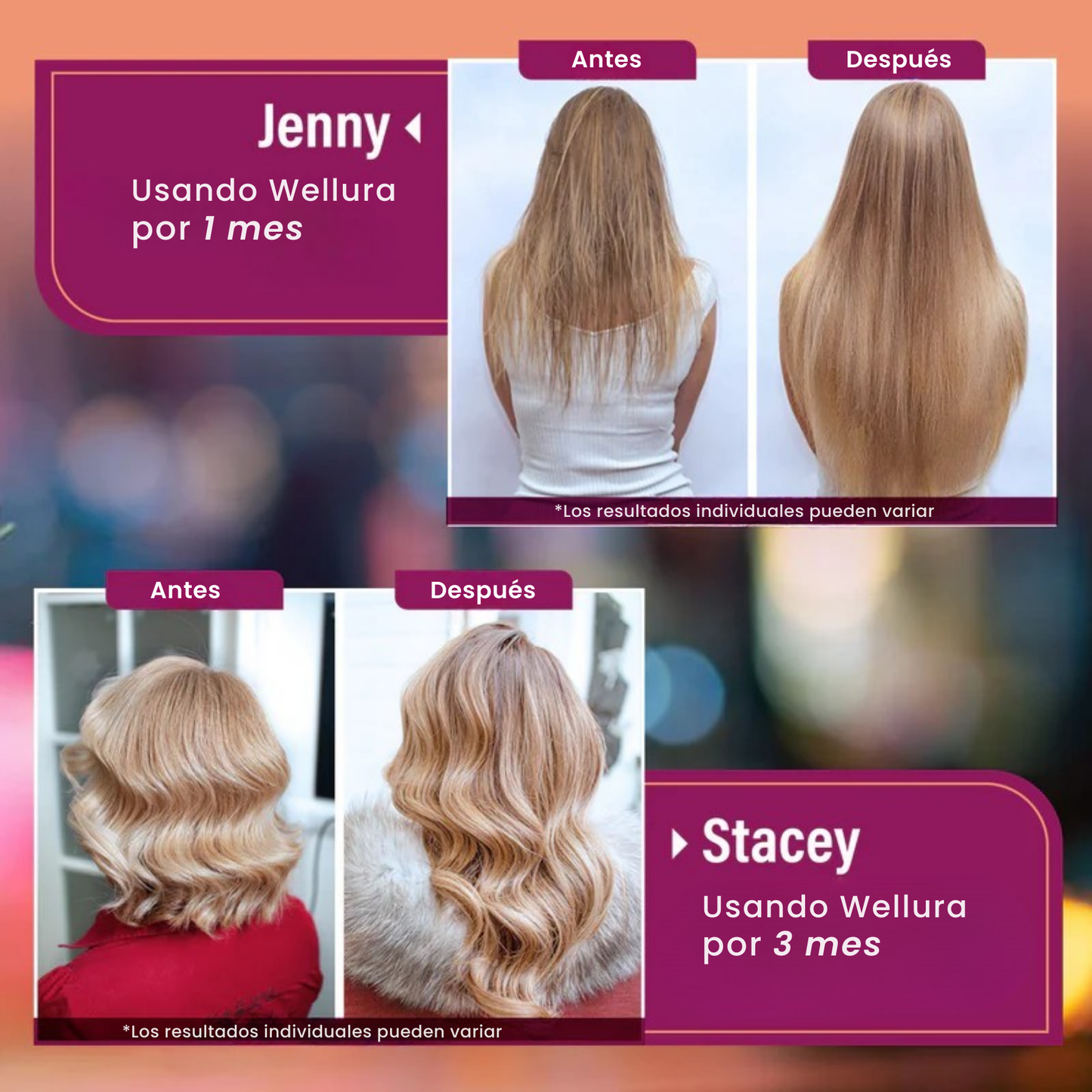 Vitaminas para el Crecimiento del Cabello