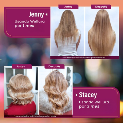 Vitaminas para el Crecimiento del Cabello